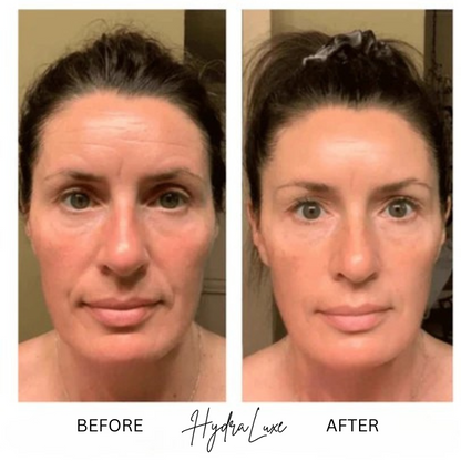 Hydraluxe Bio-Collagen Mask